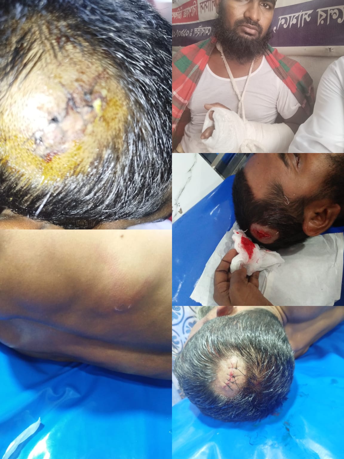 ​বটিয়াঘাটায় আদালতের নিষেধাজ্ঞা অমান্য করে বসতবাড়িতে হামলা: নারীসহ একই পরিবারের ৬ জন রক্তাক্ত জখম